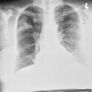 Fundamental Digital Marketing for Beginners